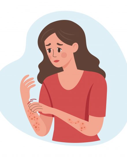 δερματική αλλεργία