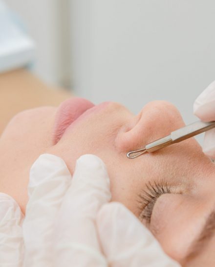 Procedure,For,Cleaning,Skin,With,Steel,Tool,From,Blackheads,And